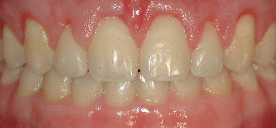 Periodontal Center of Excellence Dental Implant Center