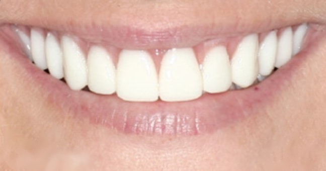 Periodontal Center of Excellence Dental Implant Center