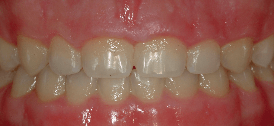 Periodontal Center of Excellence Dental Implant Center